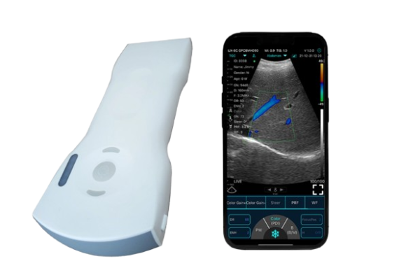 C10XS 3-in-1 Dual-Head Wireless Pocket HD Ultrasound