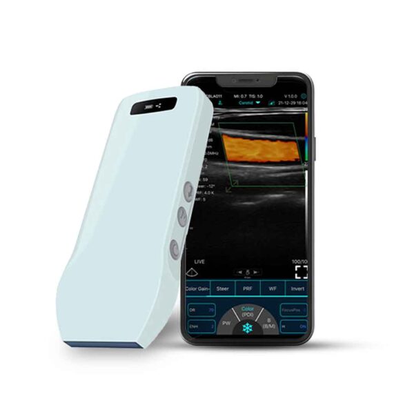 C10CX – Wireless Convex Color Doppler Ultrasound Probe