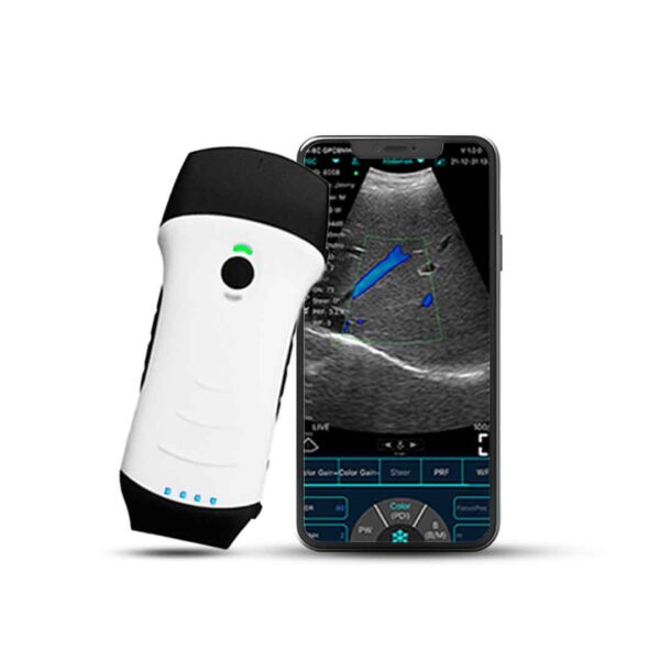  C10TX – Wireless Linear Color Doppler Ultrasound Probe
