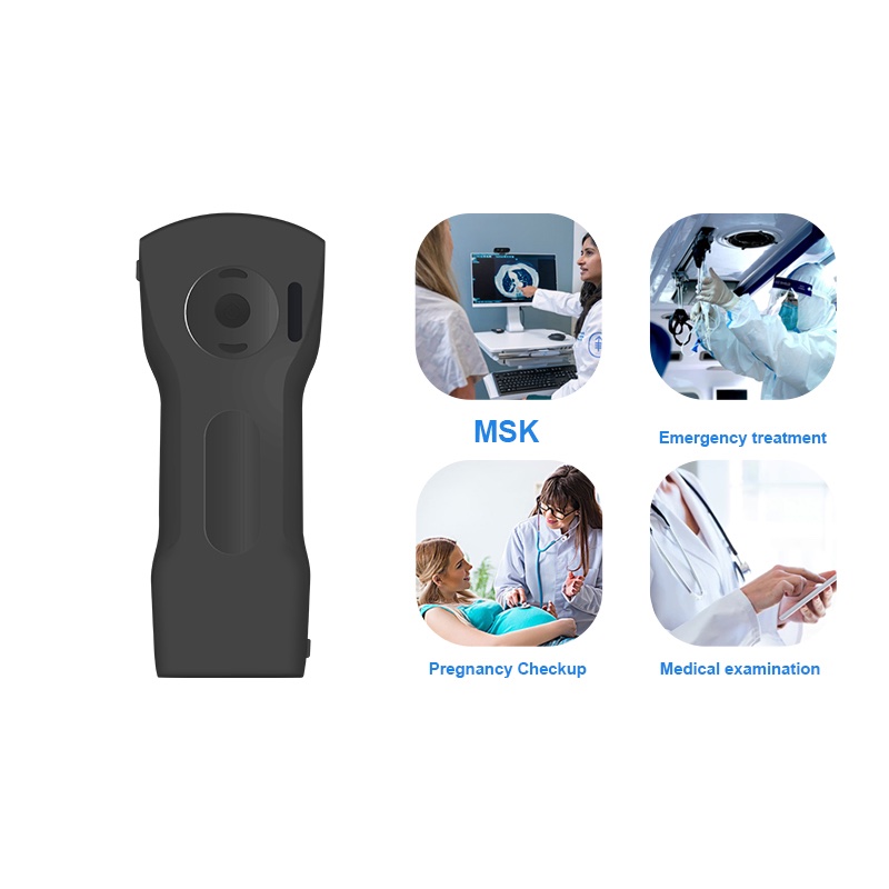 Konted-C10XS-Wireless-Handheld-3-in-1-Probes-Ultrasound-High-Definition-192E-Color-Doppler-Ultrasound-CE-FDA-Certified-Compatible-with-IOS-and-Android (1)