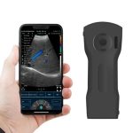 C10XS 3-in-1 Dual-Head Wireless Pocket HD Ultrasound,