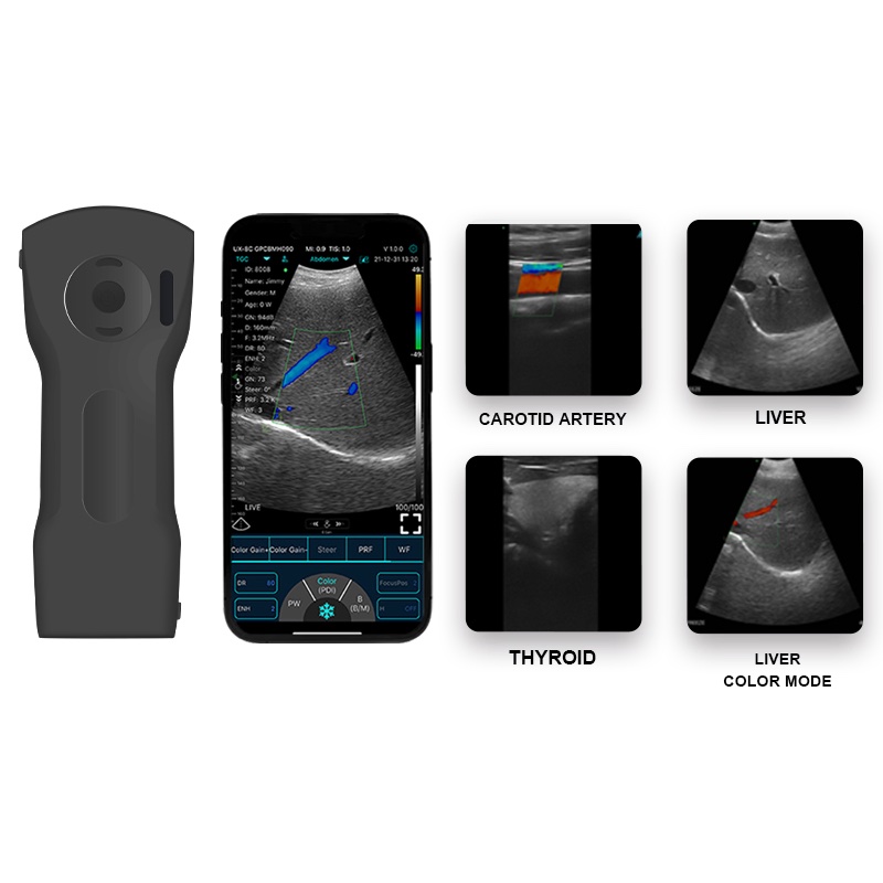 Konted-C10XS-Wireless-Handheld-3-in-1-Probes-Ultrasound-High-Definition-192E-Color-Doppler-Ultrasound-CE-FDA-Certified-Compatible-with-IOS-and-Android