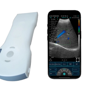 C10XS 3-in-1 Dual-Head Wireless Pocket HD Ultrasound